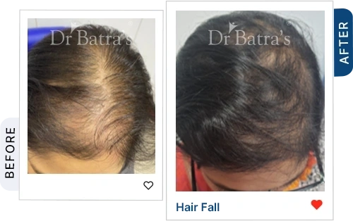 003 Homeopathy Before After