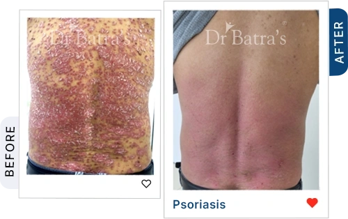 01 Homeopathy Before After