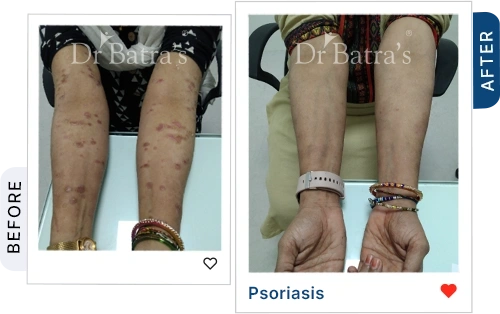 02 Homeopathy Before After