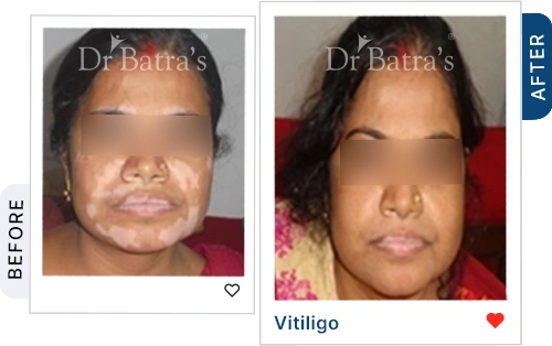 03 Homeopathy Before After