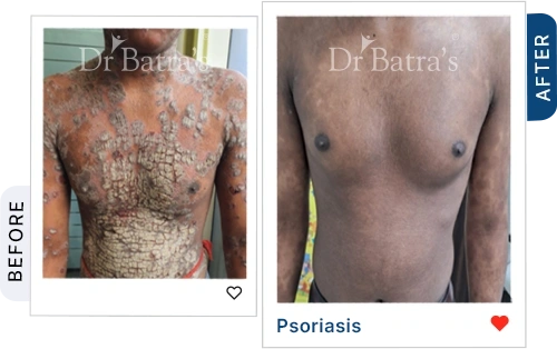04 Homeopathy Before After