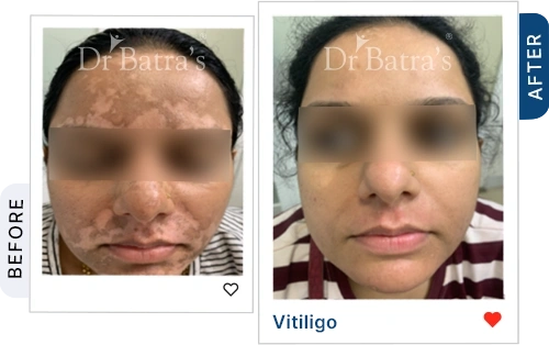 05 Homeopathy Before After