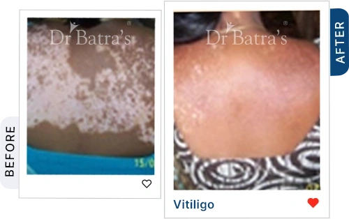 06 Homeopathy Before After