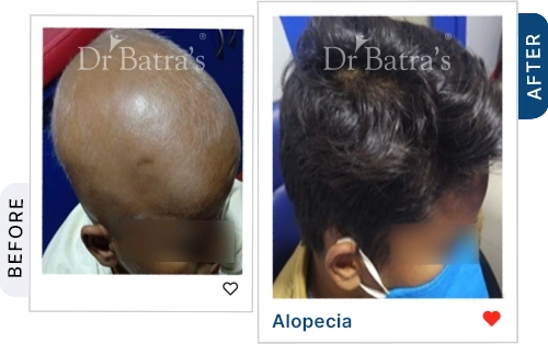 07 Homeopathy Before After