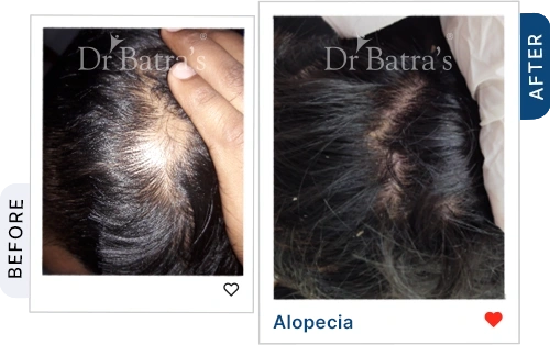 08 Homeopathy Before After