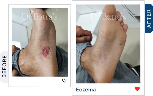 10 Homeopathy Before After