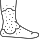 Psoriasis-icon
