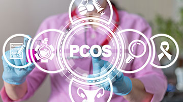 pcos