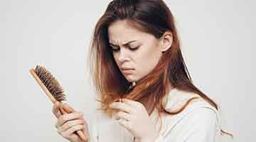 female pattern baldness