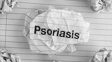 psoriasis