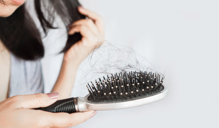 female pattern baldness