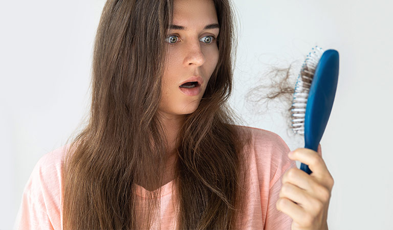 female pattern baldness