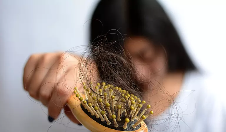 female pattern baldness