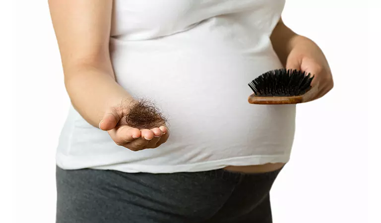 female pattern baldness