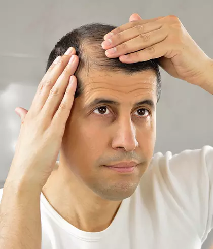 What is the best hair fall treatment for men?
