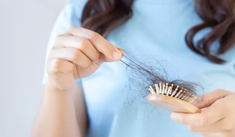 female pattern baldness