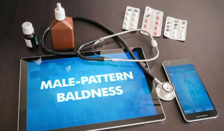 male pattern baldness