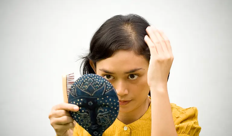 female pattern baldness