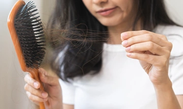 female pattern baldness