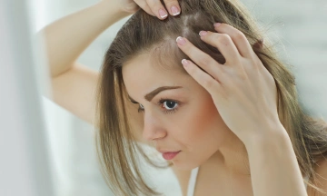 female pattern baldness