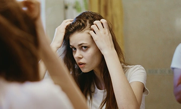 female pattern baldness