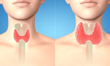 thyroid