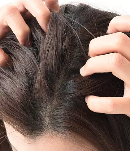 The Wins Salon  Do you have the following hair and scalp problems Our  herbal scalp treatment can help you improve your scalp problemslet your  hair grow healthy Those who try this