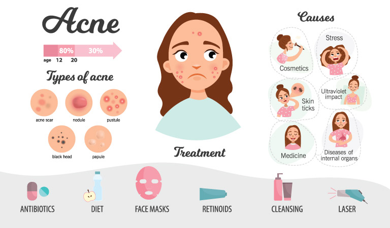 Top 13 commonly asked questions about acne - Dr Batra’s®