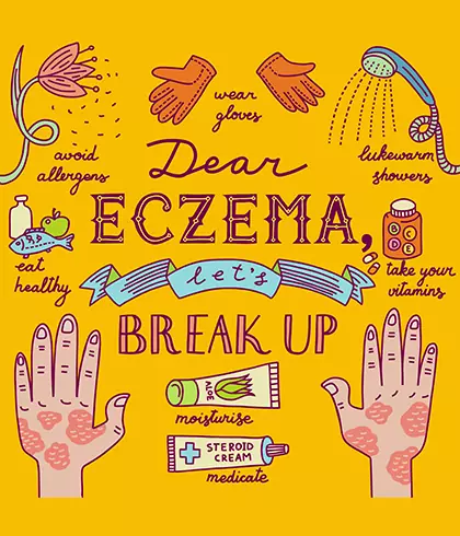 Risk factors for developing eczema