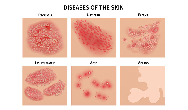 Your homeopathic guide to healthy skin  Dr Batra’s™