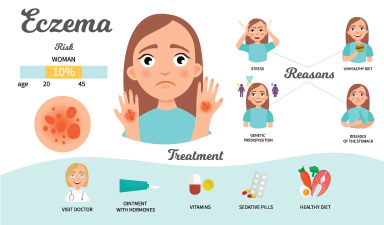 Tackle eczema this monsoon with homeopathy | Dr Batra’s™