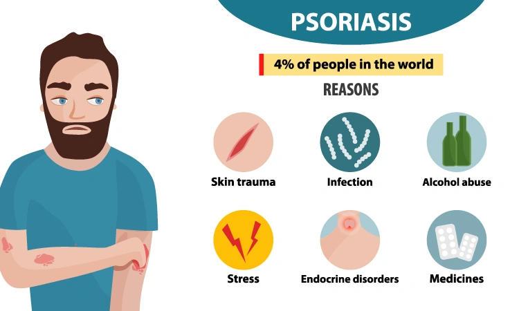 Skin rash? It might be Psoriasis