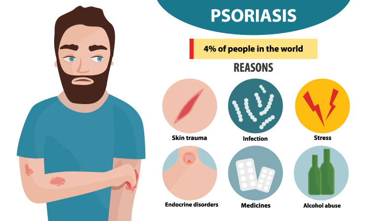 Skin rash? It might be Psoriasis | Dr Batra’s™