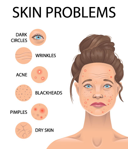 How psyche affects your skin health?