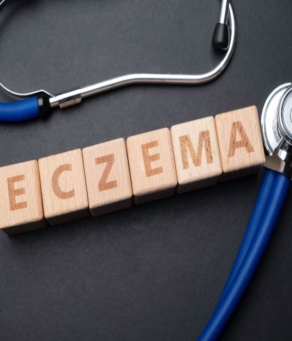 Types of eczema and homeopathy treatment