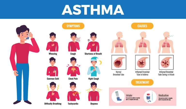 Childhood Asthma Vs. Adult-onset Asthma 