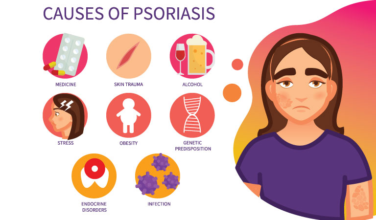 Skincare mistakes to avoid if you've Psoriasis