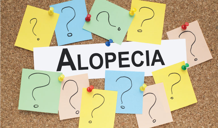 Why Homeopathy is the best treatment for Alopecia Areata?