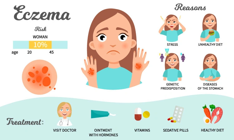 Top 5 surviving tips for itchy eczema days