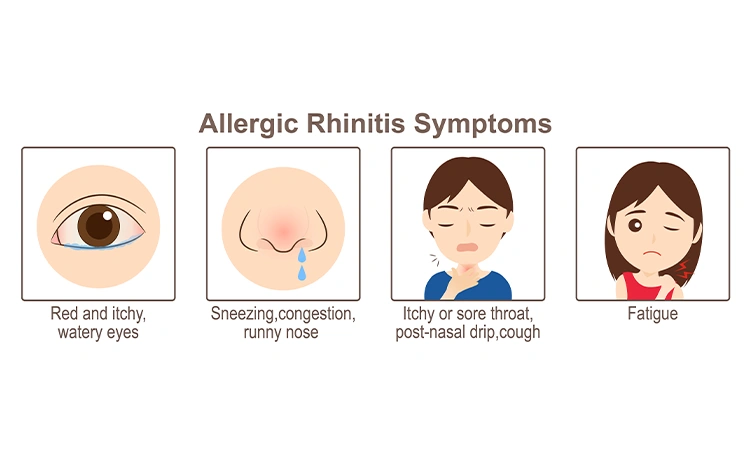 Living with allergies? Try homeopathy