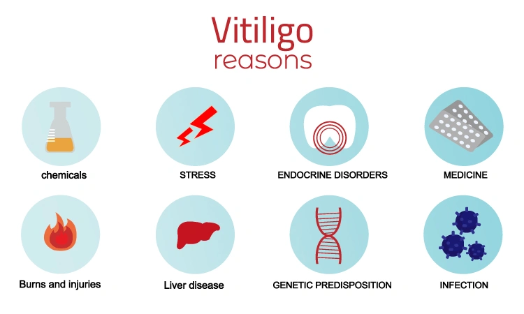 Skincare tips if you have vitiligo