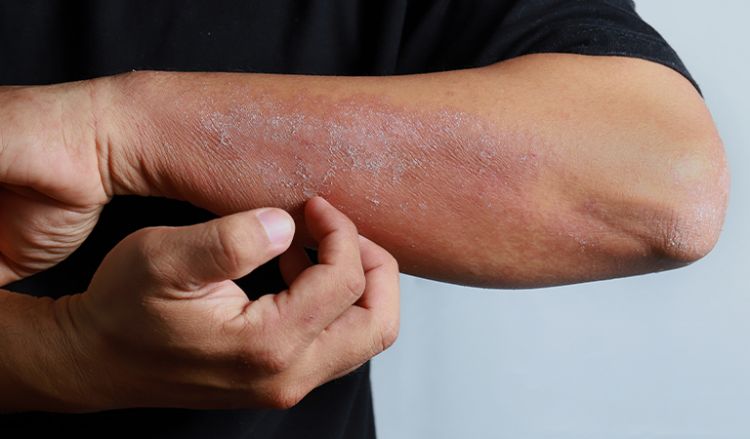 What Causes Skin Infections?