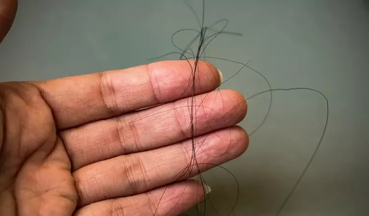 What are the reasons for hair fall?