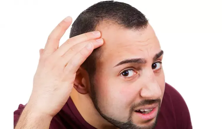 What to do about male pattern hair loss?