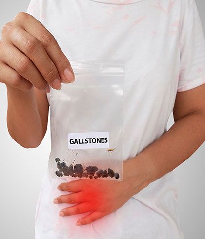 How To Roll Out Gallstones Using Homeopathy Dr Batra S