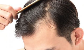 Homeopathy - Safest treatment for your hair