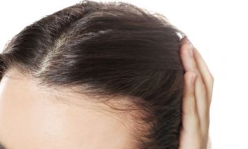 Myths about hair loss in women