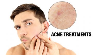 How to deal with sudden acne breakout on face? | Dr Batra’s™