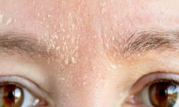 How to take care of dry skin? - Dr Batra's®