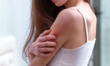 Clear eczema with homeopathy